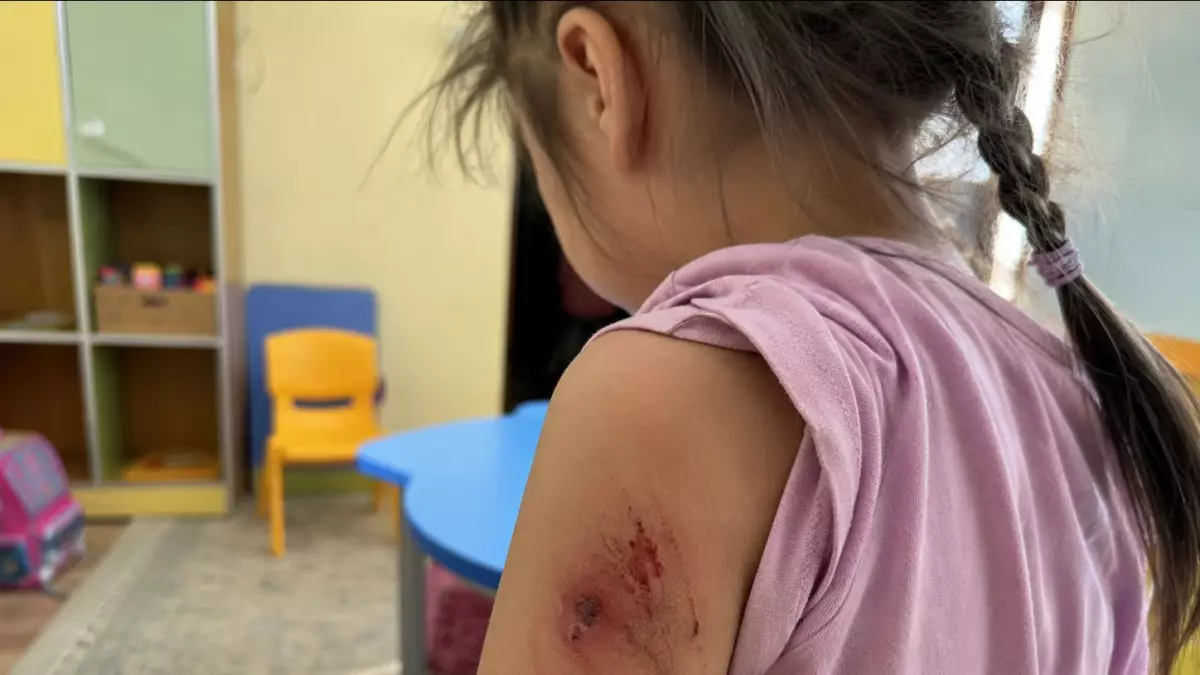 «Көзі көгеріп, мұрны қанап келді»: Қосшыдағы балабақшада дау шықты
