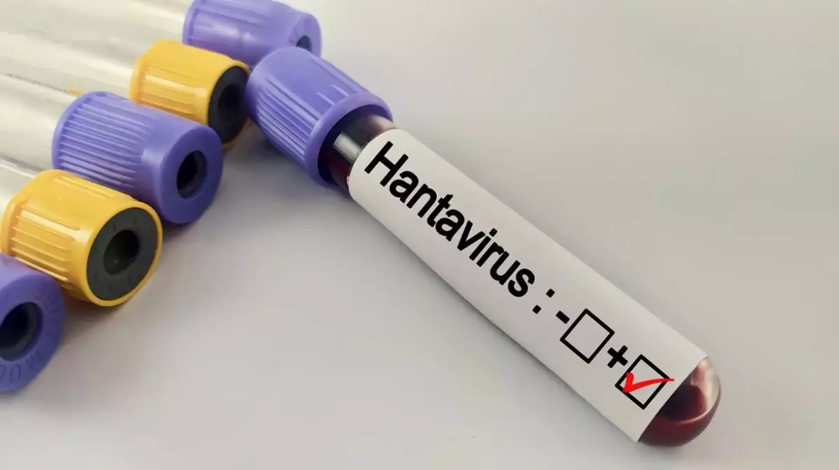 COVID-19 ізімен: Хантавирустың өршуіне қатысты байлам айтылды