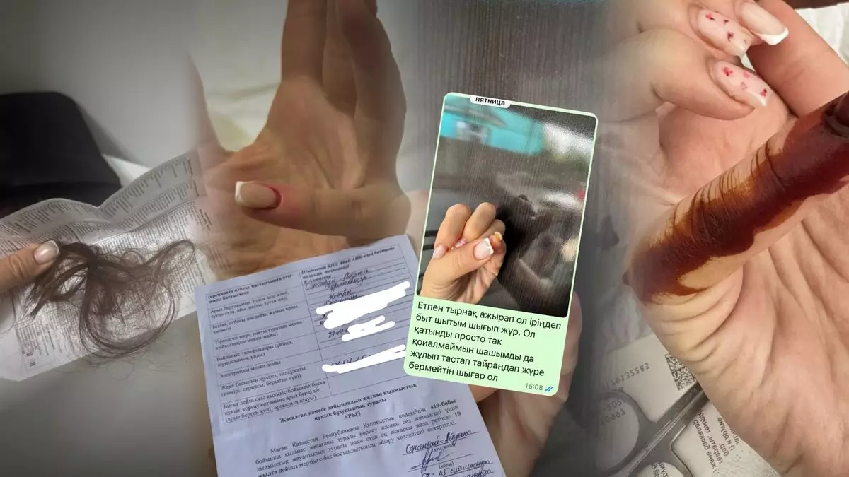 Пациентке вырвали волосы и чуть не оставили без ногтей в больнице Шымкента