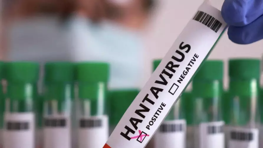  Әлемді алаңдатқан хантавирус: қазақстандықтарға маңызды ескерту жасалды 