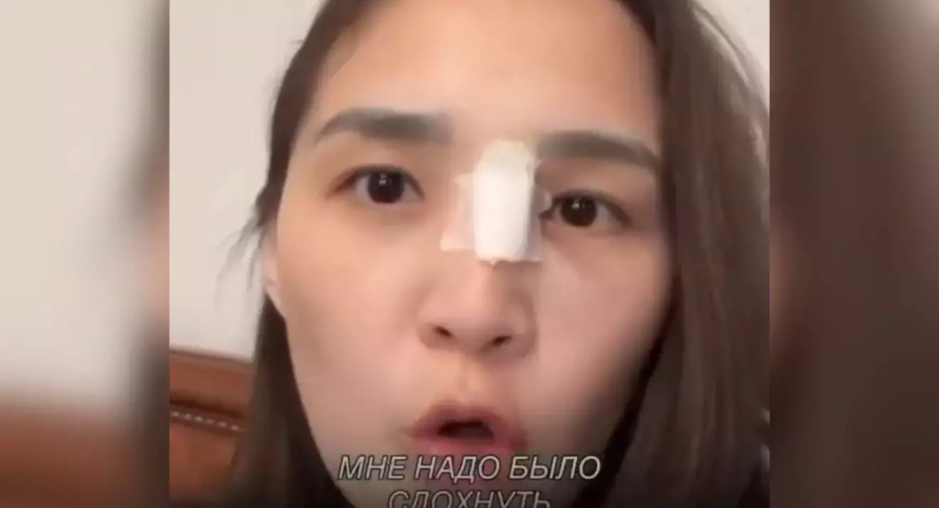 Өтемақыға футболка: «Ақтөбе» ФК жанкүйердің басын жарғаны үшін жеңіл құтылмақ болған