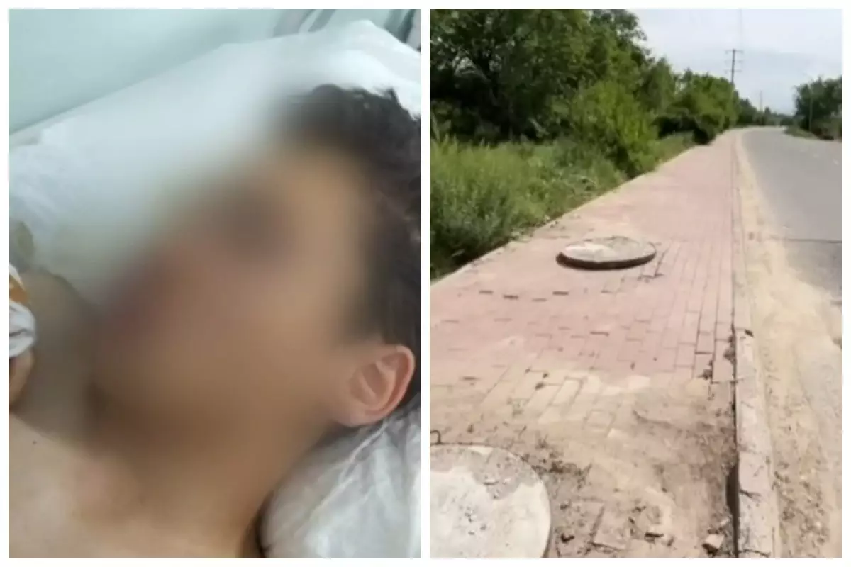 Велосипедпен құдықтың бетон қақпағына соғылған жасөспірім омыртқасын зақымдады