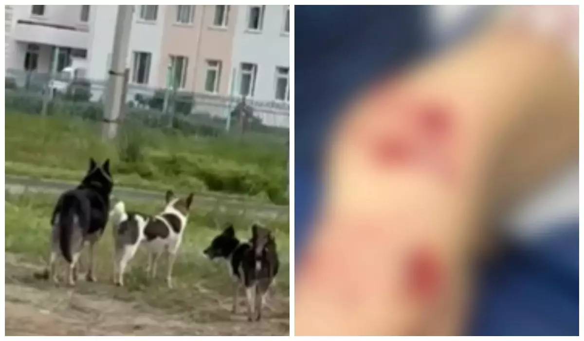 Оралда бір топ бұралқы ит бес жасар баланы талап тастаған