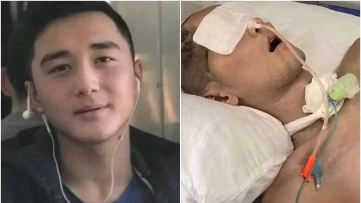 Әскерде мүгедек болып қалған Ербаян Мұхтардың жағдайы күрт нашарлады