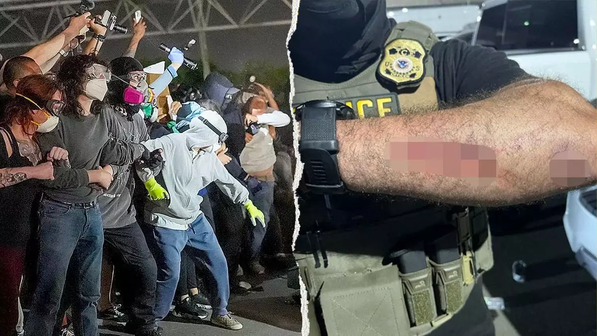 Мужчине предъявлено обвинение в нападении на федеральных офицеров после того, как он, предположительно, укусил агентов ICE на протесте против ICE в Ньюарке.