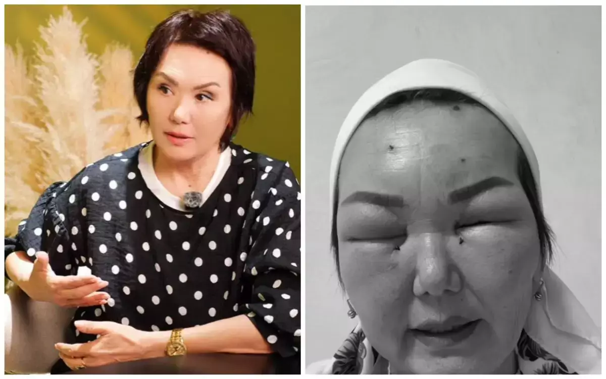 «Осымен бәрі бітті деп ойладым»: өлім аузынан қалған блогер көрген қиындықтарын айтты