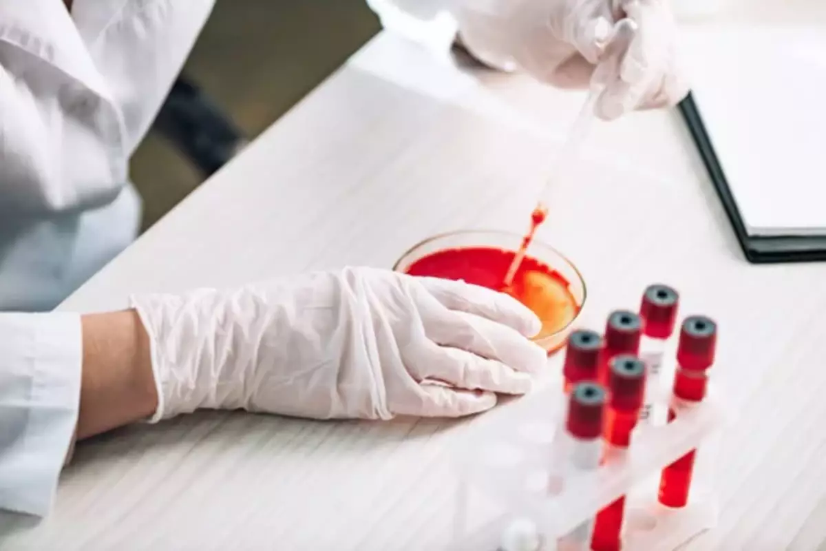 Еуропада өлімге әкелуі мүмкін қауіпті инфекция тарала бастады