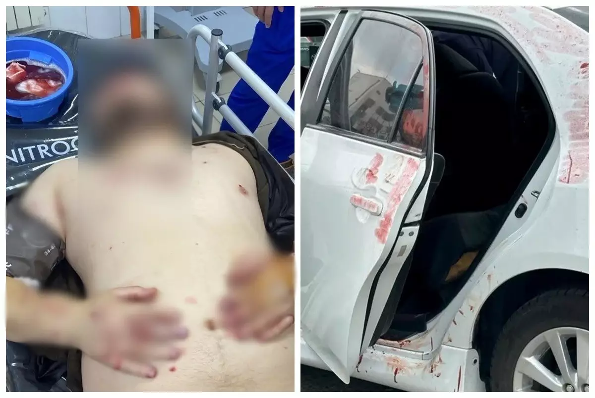 Ақтау маңында көлік жуатын орында атыс болып екі адам ауруханаға түсті