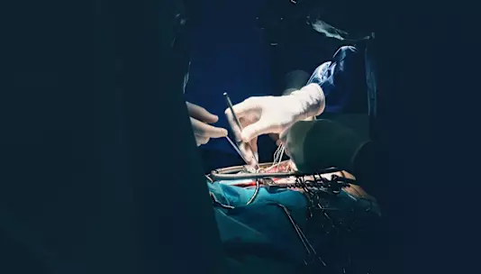 Компания TRiCares начинает ключевое клиническое исследование IDE в США для своей системы транскатетерной трикуспидальной замены клапана.