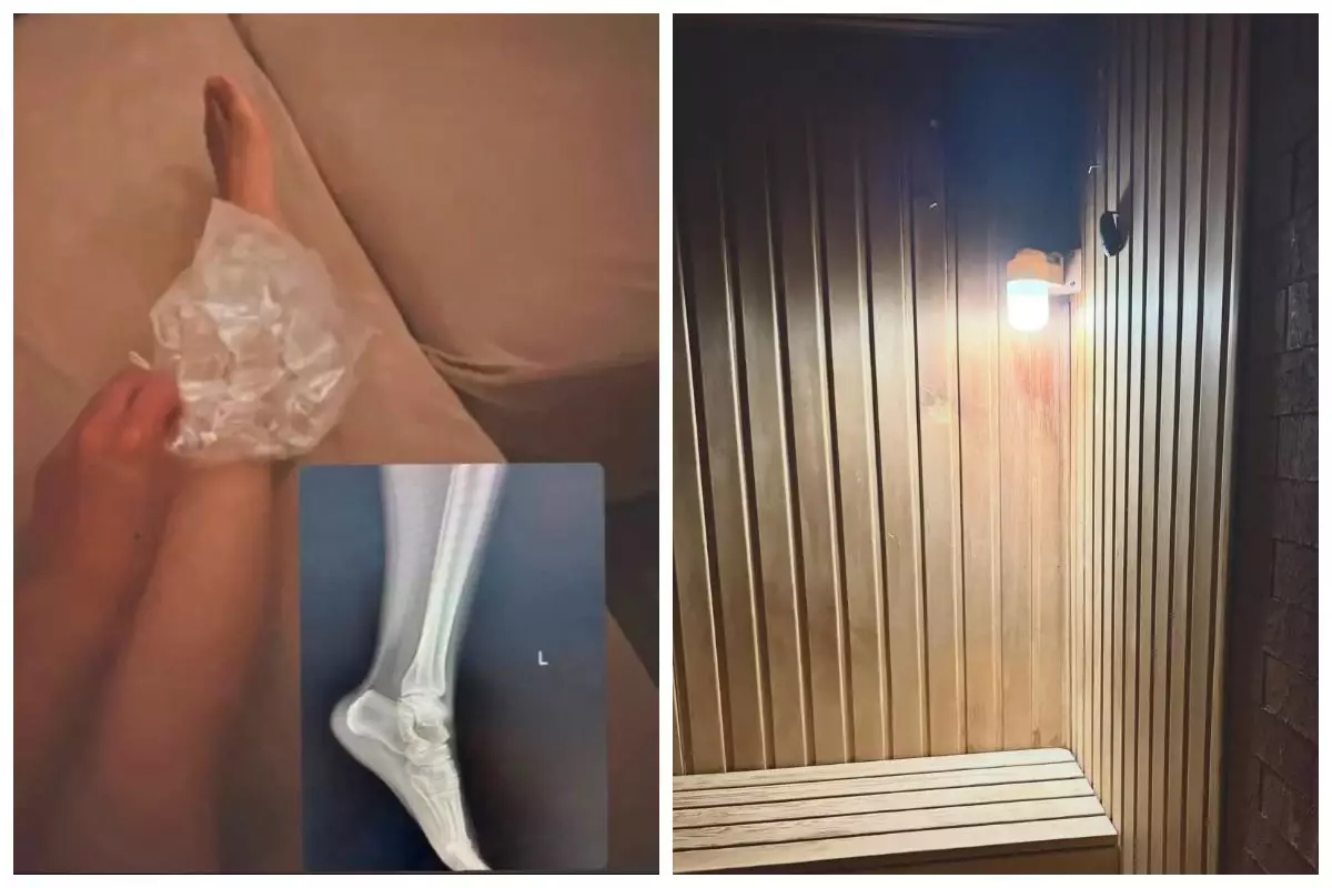 SPA-да аяғына шам құлаған қазақстандықты қызметкерлер "алаяқ" деп айыптады