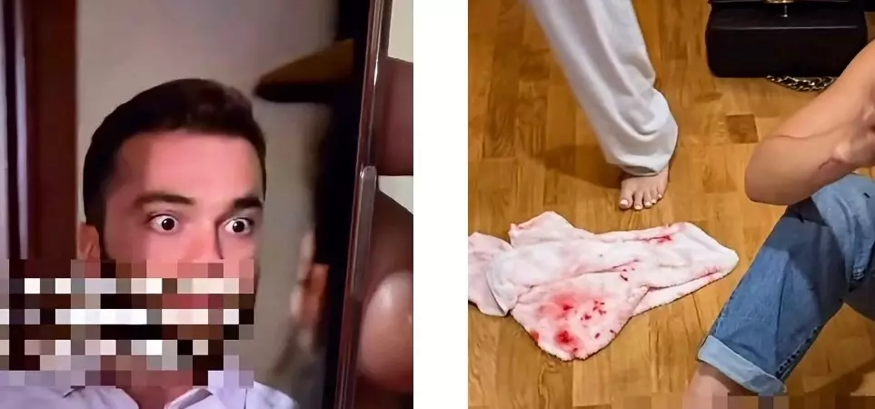  Грузиядағы қонақүйде ресейлік туристі соққыға жыққан күдікті ұсталды 