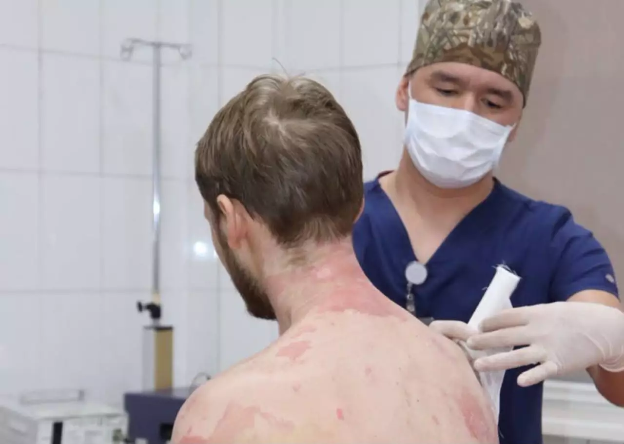 В Алматы врачи спасли мужчину с ожогами 89% тела после взрыва газового баллона