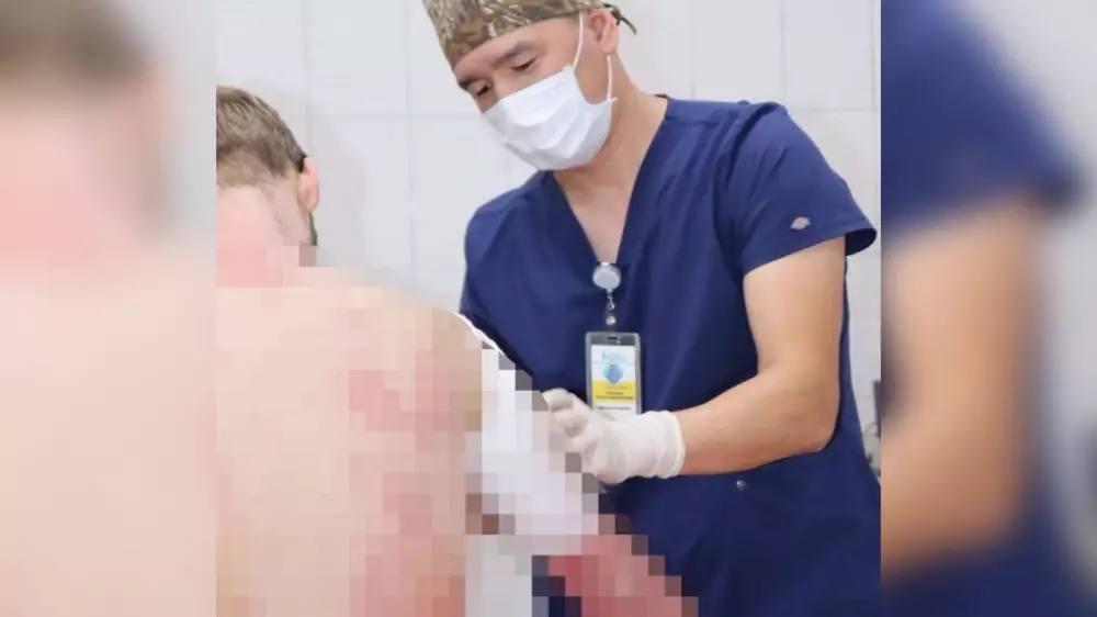 Алматыда денесінің 90 пайызға жуығын күйік шалған ер адам құтқарылды
