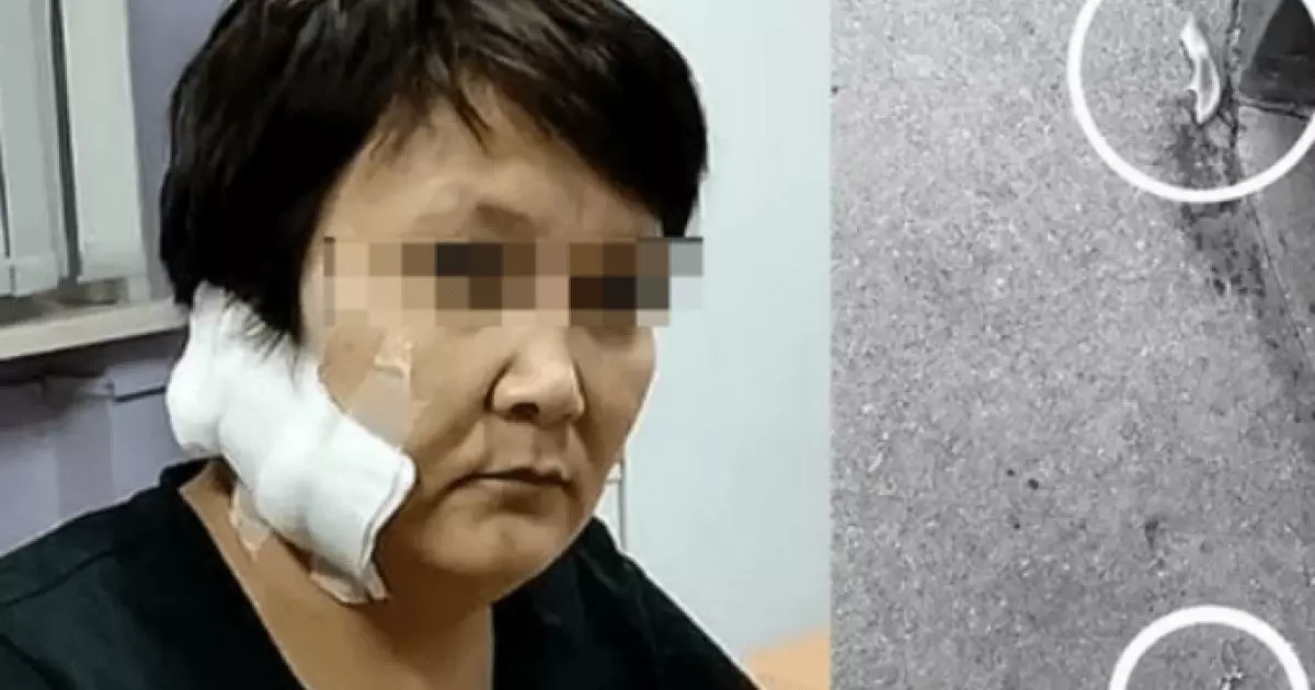  «Алты баланың анасы»: Шығыс Қазақстан тұрғыны бұрынғы әйелінің құлағын кесіп алған 