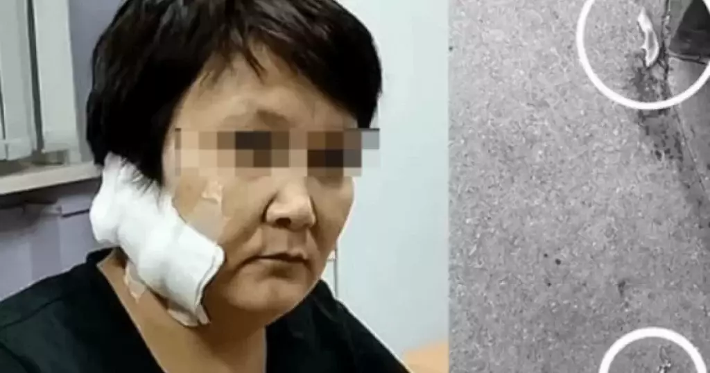 Шығыс Қазақстан тұрғыны бұрынғы әйелінің құлағын кесіп алған
