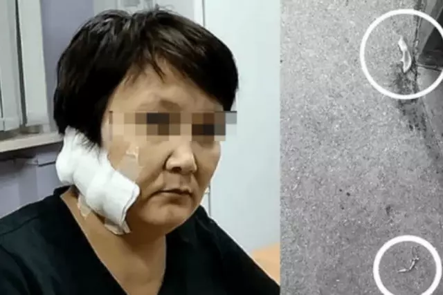 ШҚО-да бұрынғы әйелінің құлағының жартысын кесіп кеткен (ВИДЕО