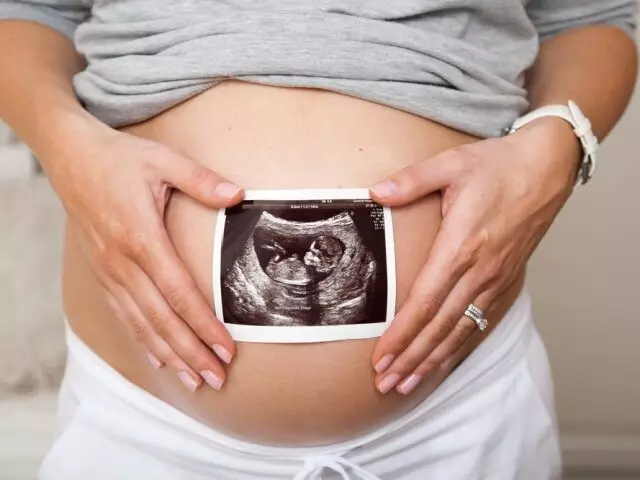 АИТВ-мен өмір сүретін ана дені сау баланы дүниеге әкеле алады