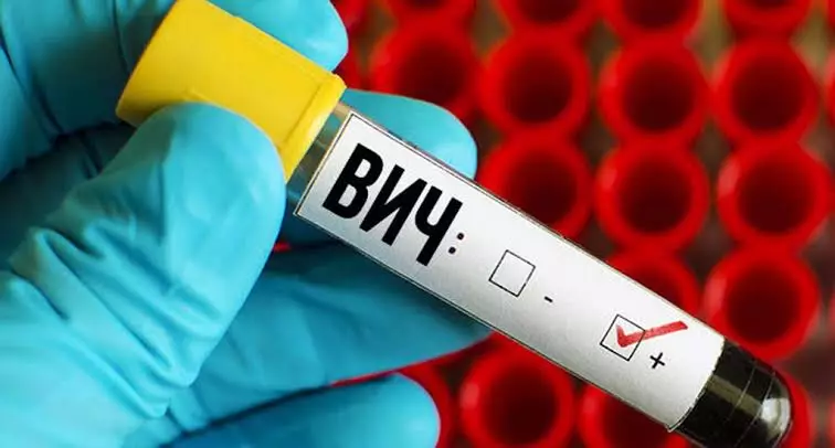 Ресейдің 27 өңірінде ВИЧ індеті кең тарап кетті