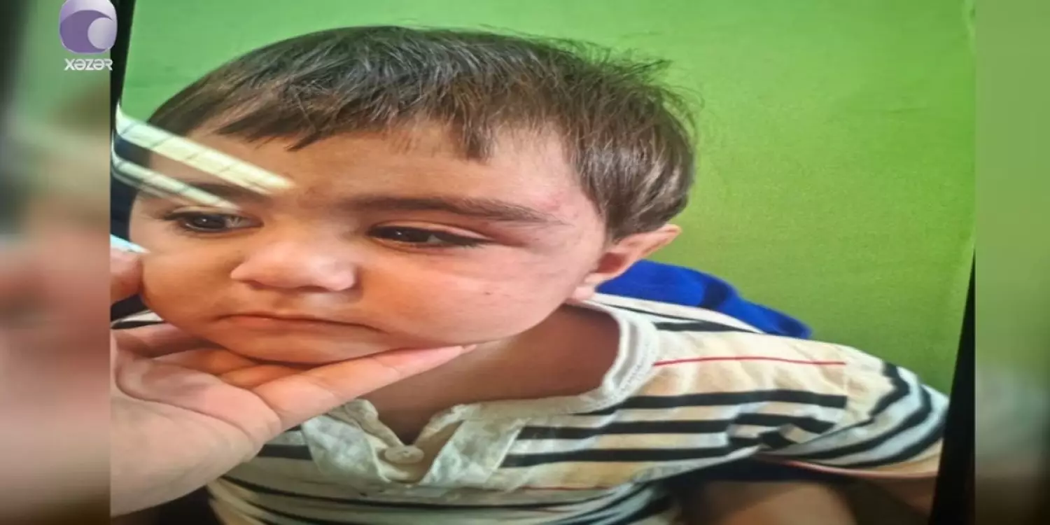 «Баспалдақтан құлаған»: Күтушінің қарауында болған екі жасар сәби көз жұмды